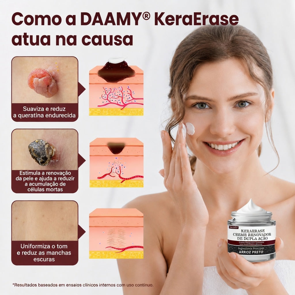 👨‍⚕️✨𝑫𝑨𝑨𝑴𝒀® KeraErase Creme Renovador de Dupla Ação