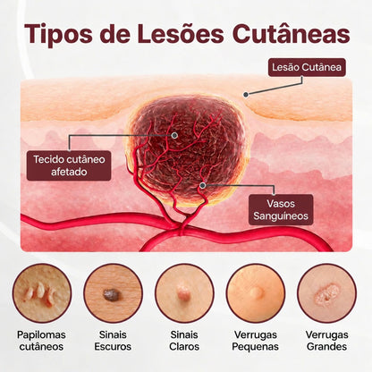 👨‍⚕️✨𝑫𝑨𝑨𝑴𝒀® KeraErase Creme Renovador de Dupla Ação