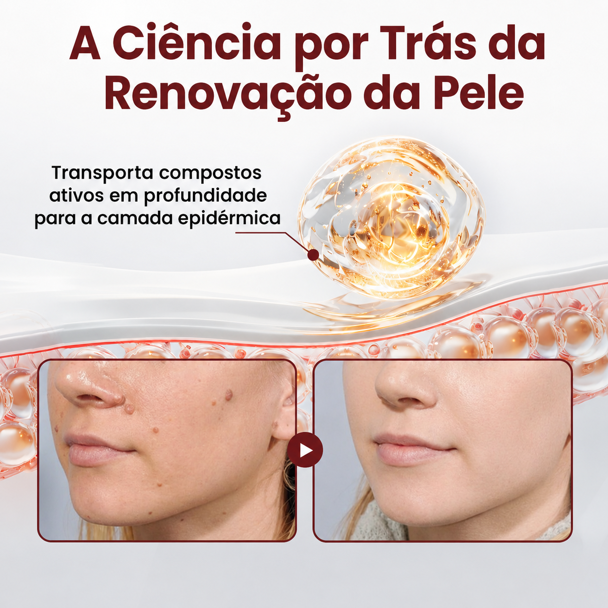 👨‍⚕️✨𝑫𝑨𝑨𝑴𝒀® KeraErase Creme Renovador de Dupla Ação