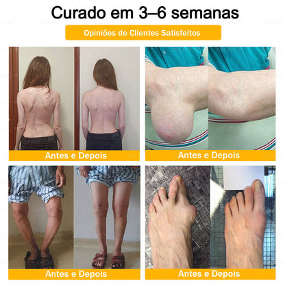 XRLXRL® Creme Reparador Ósseo e Alívio da Dor com Veneno de Abelha (Especialmente desenvolvido para pessoas idosas)